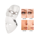 Máscara LED 7 Cores para Fototerapia Facial – Rejuvenescimento, Acne e Firmeza da Pele